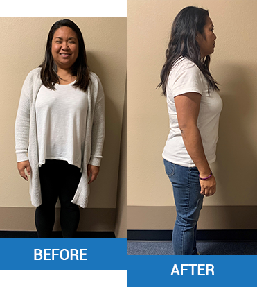 Before-Afters-sasha-santos